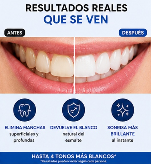 Tratamiento Blanqueador DENTAL! Con polvo quitamanchas de regalo!